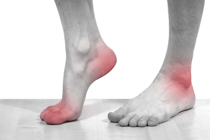 Đau bàn chân là bệnh gì?