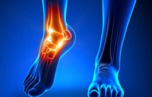 Đau khớp cổ chân: Nguy cơ tiềm ẩn biến chứng, Cách chữa đau cổ chân hiệu quả
